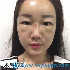��������Ů��ҽԺ�沿֬����䰸��