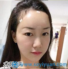 ��������Ů��ҽԺ�沿֬����䰸��