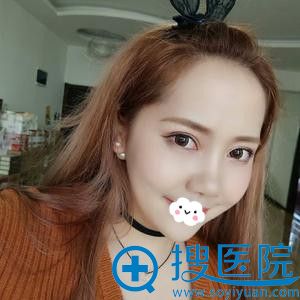 <!--<i data=20240710 data-id=12341></i>-->双眼皮效果怎么样 <!--<i data=20240710 data-id=12341></i>-->双眼皮效果怎么样
