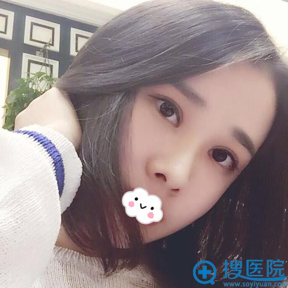 <!--<i data=20240710 data-id=8402></i>-->黄海彬眼综合效果好吗 <!--<i data=20240710 data-id=8402></i>-->黄海彬眼综合效果好吗