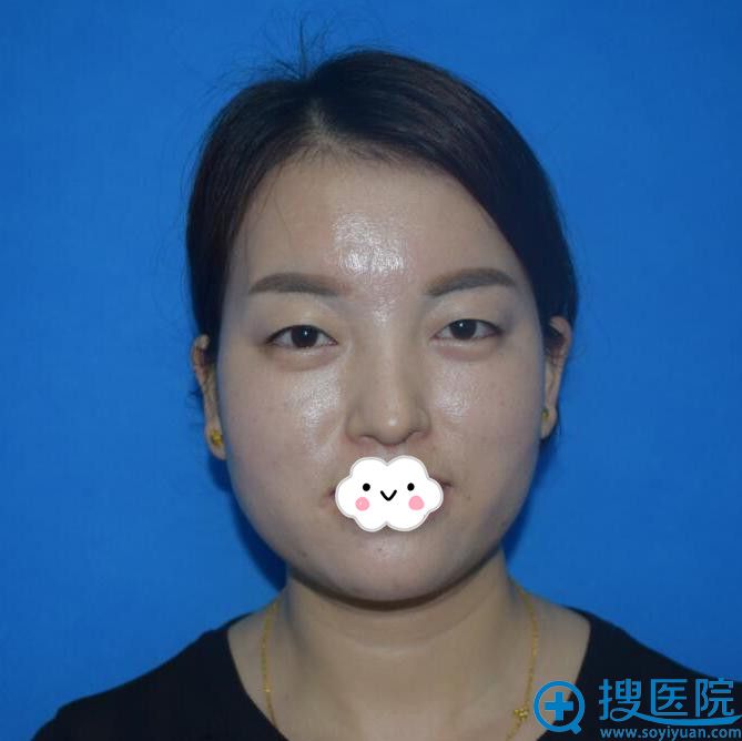 �����ʰ����紺��˫��Ƥ+���۴�����