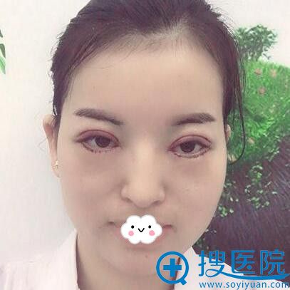 �����ʰ����紺���п�˫��Ƥ+���۽ǰ���