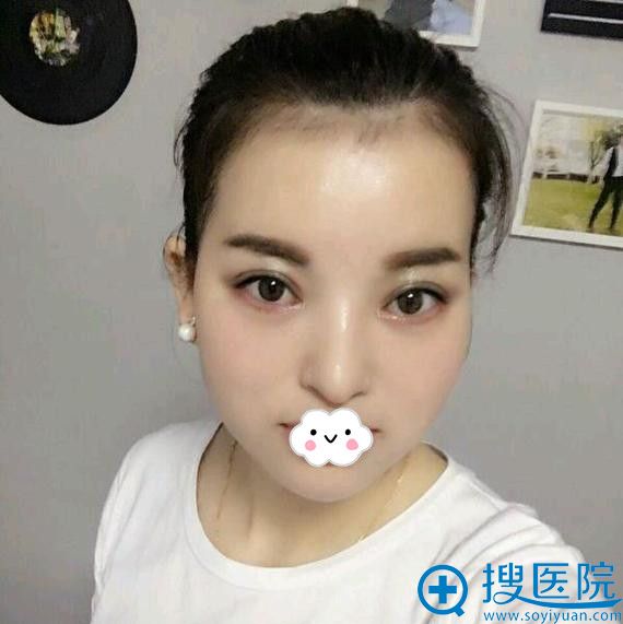�����ʰ����紺�����ۺ�+���۴�����Ч����ô��