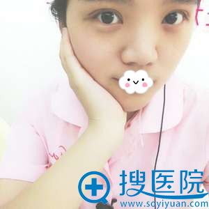<!--<i data=20240710 data-id=9128></i>-->埋线失败眼综合修复效果 <!--<i data=20240710 data-id=9128></i>-->埋线失败眼综合修复效果