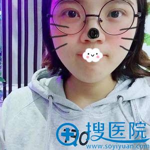<!--<i data=20240710 data-id=9128></i>-->眼综合真人案例恢复效果 <!--<i data=20240710 data-id=9128></i>-->眼综合真人案例恢复效果