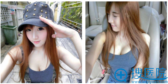 �ҳ��²ܼ�����ҽԺ<!--<i data=20240710 data-id=16556></i>-->��������֬�����ذ����ͼƬ