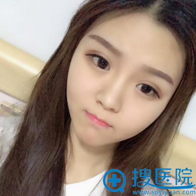 <!--<i data=20240710 data-id=13535></i>-->整形医院孔庆颂双眼皮案例术后三个月效果图 <!--<i data=20240710 data-id=13535></i>-->整形医院孔庆颂双眼皮案例术后三个月效果图