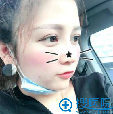 找<!--<i data=20240710 data-id=12158></i>-->医院龚涛院长做鼻子二十天了 找<!--<i data=20240710 data-id=12158></i>-->医院龚涛院长做鼻子二十天了