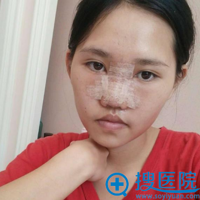 ���Ϻ��ں�ױ�������ۺ�¡����������Ч��ͼ