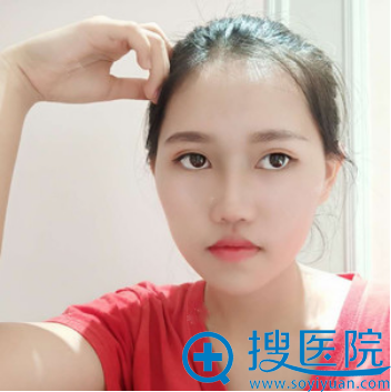 ���Ϻ��ں�ױ����ҽԺ������ۺ�¡�����ָܻ�ͼƬ