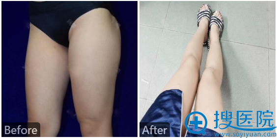 ���Ϻ������ݻ�ר������ҽԺ�����Ǵ�����֬����ͼ