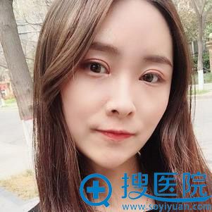 西安韩媚面部填充案例 西安韩媚面部填充案例