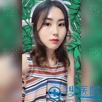 去<!--<i data=20240710 data-id=12670></i>-->做完双眼皮半个月自拍 去<!--<i data=20240710 data-id=12670></i>-->做完双眼皮半个月自拍