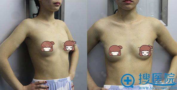 �������人�а�����˫��Ƥ,�����Ƽ������а����ٷ���֬��¡��