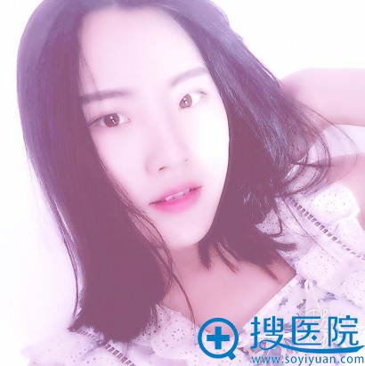 对比了四川华美紫馨郑岩和艾剑英的案例后找艾剑英做的双眼皮