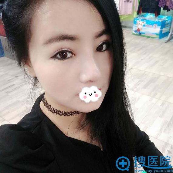 ��ʯ�а�����˫��Ƥʧ���п�˫��Ƥ�޸�����
