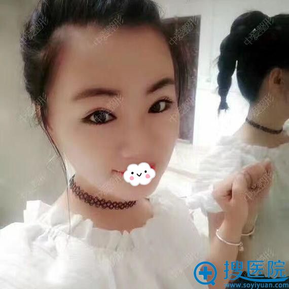 ��ʯ�а�˫��Ƥ�޸����˰���