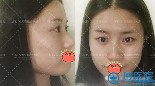 �ڻ������ˡ������ͺ���֮����ѡ�����˷�������˫��Ƥ���°�