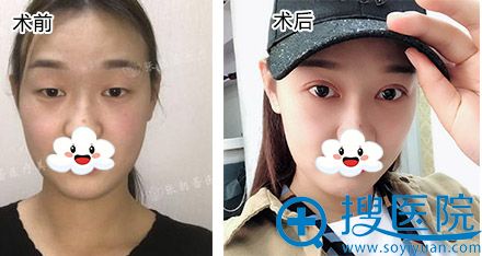 20180802_1533176045667346.jpg 对比.jpg