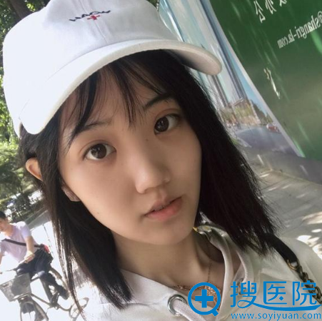 找武汉亚韩赵贵庆做完下颌角术后六天效果 找武汉亚韩赵贵庆做完下颌角术后六天效果