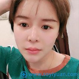 <!--<i data=20240710 data-id=16916></i>-->整形许飞面部脂肪填充 <!--<i data=20240710 data-id=16916></i>-->整形许飞面部脂肪填充