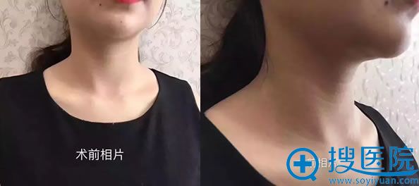 20����о���,����������������������ư���¾�����ʧ��