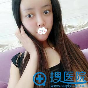 <!--<i data=20240710 data-id=8401></i>-->吉梅斯自体脂肪面部填充效果怎么样 <!--<i data=20240710 data-id=8401></i>-->吉梅斯自体脂肪面部填充效果怎么样
