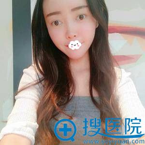 深圳自体脂肪填充哪家好?<!--<i data=20240710 data-id=8401></i>-->吉梅斯真人案例 深圳自体脂肪填充哪家好?<!--<i data=20240710 data-id=8401></i>-->吉梅斯真人案例