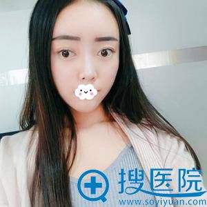 <!--<i data=20240710 data-id=8401></i>-->吉梅斯自体脂肪丰面术后效果 <!--<i data=20240710 data-id=8401></i>-->吉梅斯自体脂肪丰面术后效果