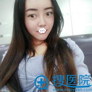 <!--<i data=20240710 data-id=8401></i>-->自体脂肪丰额头+太阳穴+苹果肌案例 <!--<i data=20240710 data-id=8401></i>-->自体脂肪丰额头+太阳穴+苹果肌案例