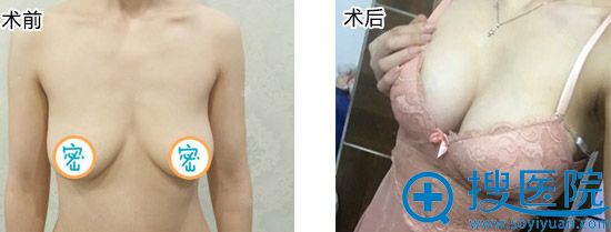 �ز��´���ˮ���Ͼ�����������Ժ��������֬��¡�غ��һ�����