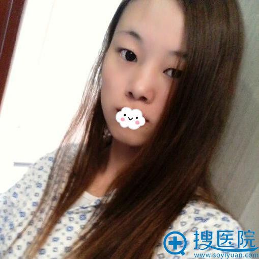 遂宁阳光丽人切开双眼皮真人案例 遂宁阳光丽人切开双眼皮真人案例