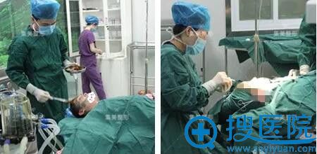郑州集美王一星自体脂肪丰额头苹果肌效果 郑州集美王一星自体脂肪丰额头苹果肌效果