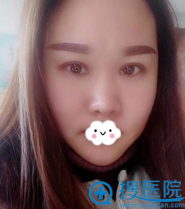 <!--<i data=20240710 data-id=8410></i>-->�п�˫��Ƥ���˰���Ч��չʾ