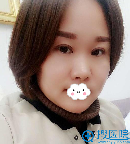���ڸ�˫��Ƥ�ļҺã�<!--<i data=20240710 data-id=8410></i>-->�п�˫��Ƥ����