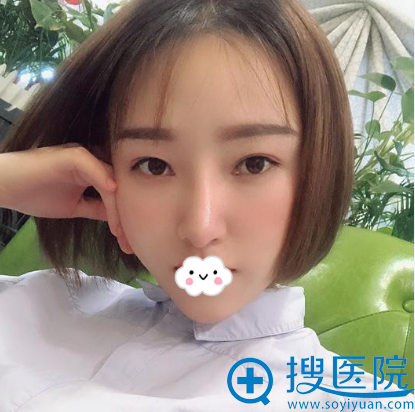 深圳江南春天隆鼻怎么样?蓝剑雄自体肋软骨真人案例 深圳江南春天隆鼻怎么样?蓝剑雄自体肋软骨真人案例