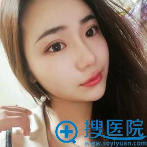 <!--<i data=20240710 data-id=9131></i>-->整形面部脂肪填充案例 <!--<i data=20240710 data-id=9131></i>-->整形面部脂肪填充案例