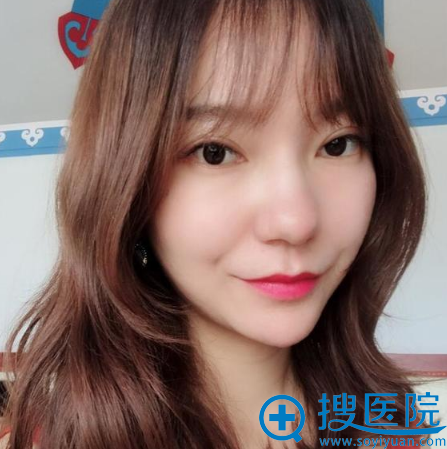 杭州瑞丽整形医院双眼皮垫下巴和自体脂肪填充案例图 杭州瑞丽整形医院双眼皮垫下巴和自体脂肪填充案例图