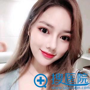 成都西区医院肖凌鼻综合案例 成都西区医院肖凌鼻综合案例