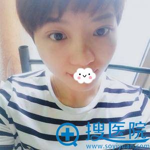 <!--<i data=20240710 data-id=12610></i>-->整形怎么样?张化博埋线双眼皮效果图 <!--<i data=20240710 data-id=12610></i>-->整形怎么样?张化博埋线双眼皮效果图