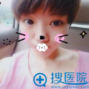 怕疼不敢切开就到<!--<i data=20240710 data-id=12610></i>-->张化博处做埋线双眼皮 怕疼不敢切开就到<!--<i data=20240710 data-id=12610></i>-->张化博处做埋线双眼皮