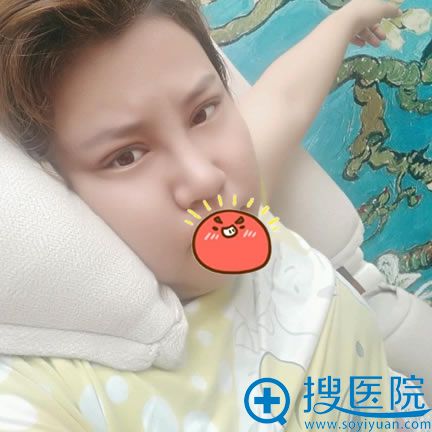 做完隆鼻和双眼皮7天效果 做完隆鼻和双眼皮7天效果