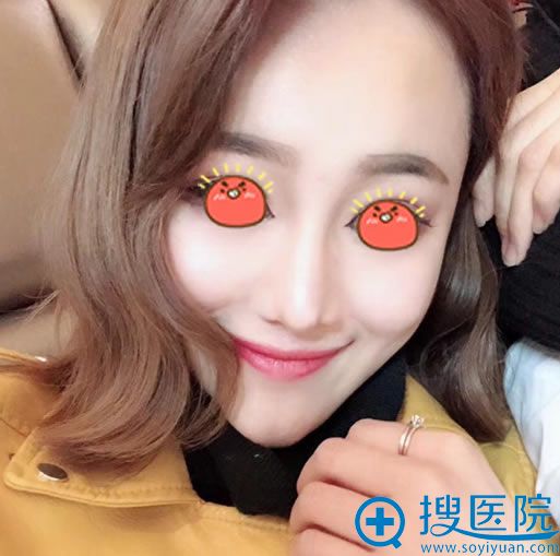 ���ֻ����κ���¡�ǰ���3����Ч��