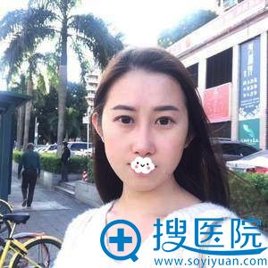 <!--<i data=20240710 data-id=13979></i>-->去眼袋+真人案例效果好吗 <!--<i data=20240710 data-id=13979></i>-->去眼袋+真人案例效果好吗