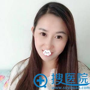 <!--<i data=20240710 data-id=13979></i>-->去眼袋+注射术后1月图片 <!--<i data=20240710 data-id=13979></i>-->去眼袋+注射术后1月图片