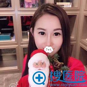 <!--<i data=20240710 data-id=13979></i>-->去眼袋+效果怎么样? <!--<i data=20240710 data-id=13979></i>-->去眼袋+效果怎么样?