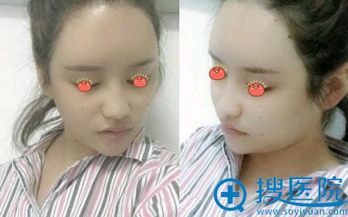 ���ź�Ͽ������֬����伴��Ч��