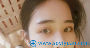 今天去郑州集美拆线了 今天去郑州集美拆线了