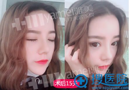 �ڳ�ɳ����¡��15��ָ���