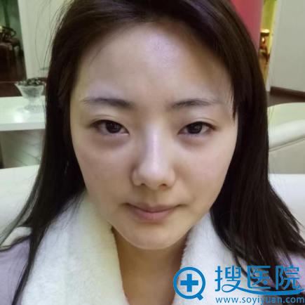 <!--<i data=20240710 data-id=12462></i>-->医院<!--<i data=20240710 data-id=16642></i>-->双眼皮术前 <!--<i data=20240710 data-id=12462></i>-->医院<!--<i data=20240710 data-id=16642></i>-->双眼皮术前